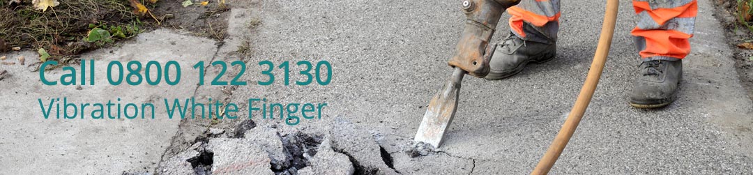 Causes of vwf Causes of vwf